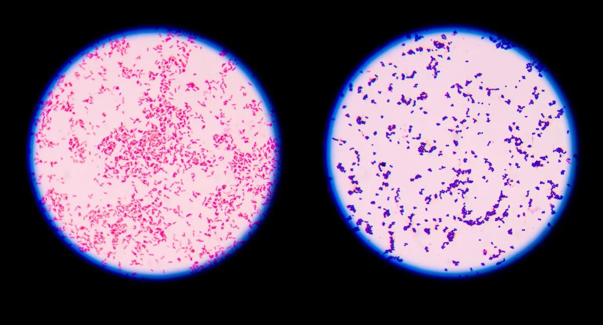 Bakterie Gram-dodatnie i Gram-ujemne – jak je rozróżnić?