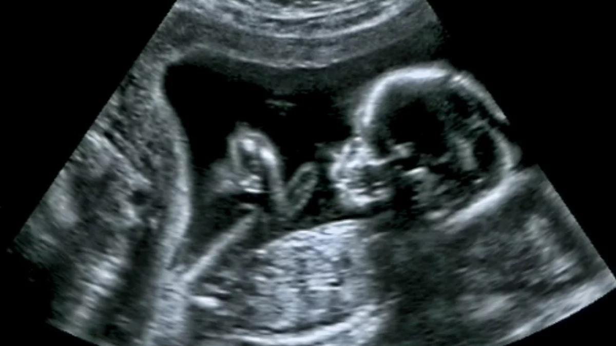 O konstytucyjnym znaczeniu życia