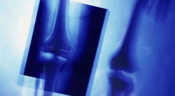 Chcesz mieć zdrowe kości? Jedz... wywar z kurzych łapek i parówki