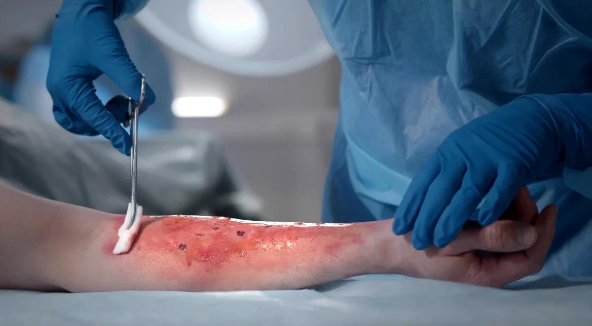  Sukces polskich naukowców. Przełomowy inteligentny opatrunek