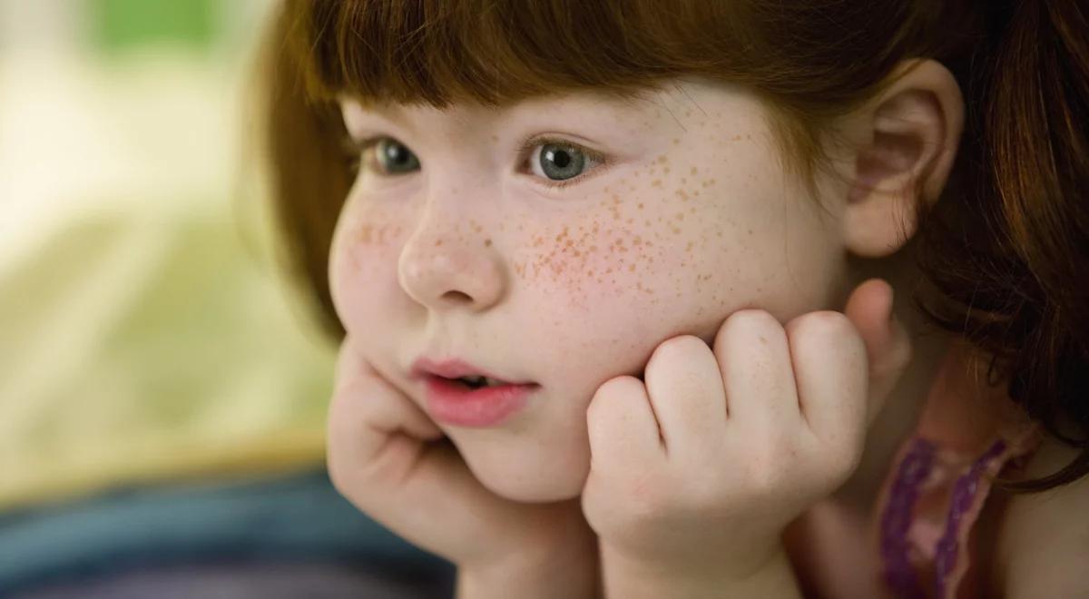 Dlaczego słońce powoduje piegi?