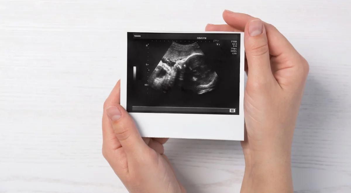 Gdy zapada cisza - żałoba po utraconej ciąży. Rozmowa z Anną Bajkowską