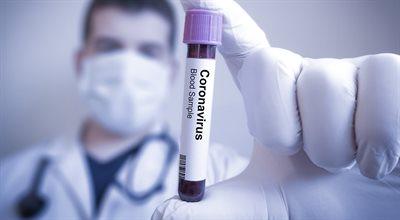 COVID-19. Koniec stanu epidemii to nie koniec koronawirusa