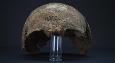 Dżuma starsza o 2000 lat niż dotąd sądzono. Odkryto szczątki pierwszej znanej ofiary "czarnej śmierci"