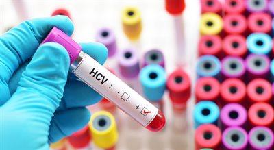 Test, który może uratować życie. Sprawdź, czy nie jesteś zakażony wirusem HCV