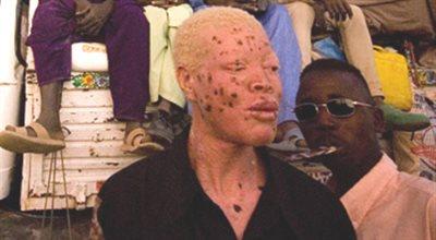 Albinosi są okrutnie prześladowani w Tanzanii. Biorą ich za duchy