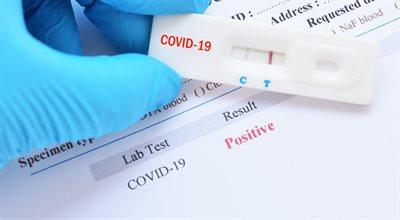 Szybkie testy antygenowe na COVID-19. Ekspert: usprawnią diagnozę, wzrośnie wykrywalność
